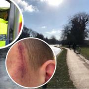 The 15-year-old boy was attacked in the afternoon in Verulamium Park, St Albans